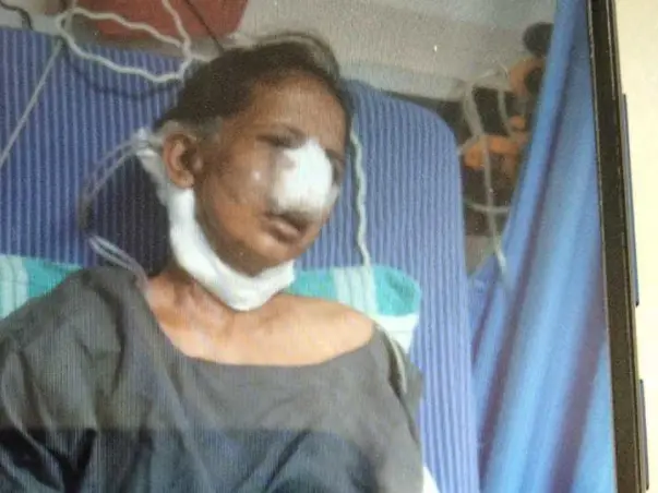 Support Sujatha Recover From Throat & Nose Cancer