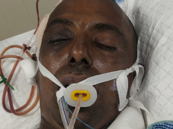 Thangavel K Needs Your Help Fight Head Injury And Neurological Shock