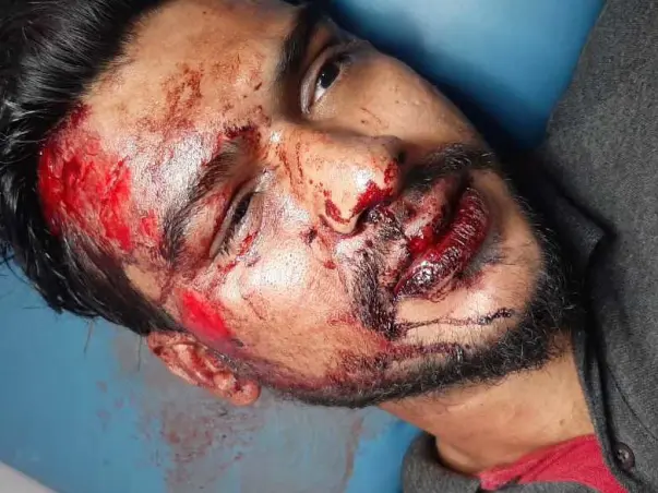 24yrs Old Irfan Needs Your Urgent Help To Recover From An Accident
