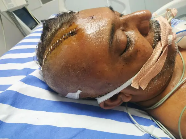 Support T. V. S. PRASAD Recover From Brain Surgery