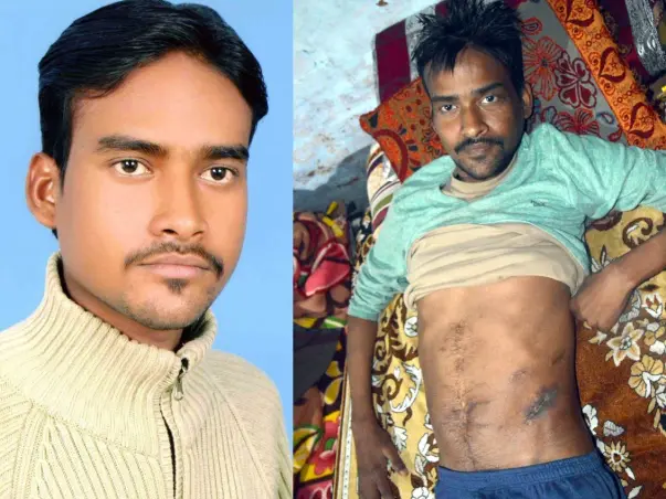 Help Amar To Recover From Enterocutaneous Fistula