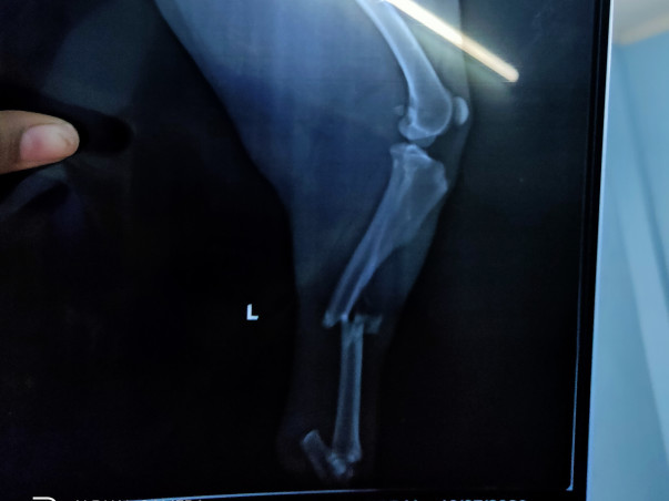 The Hit And Run Case