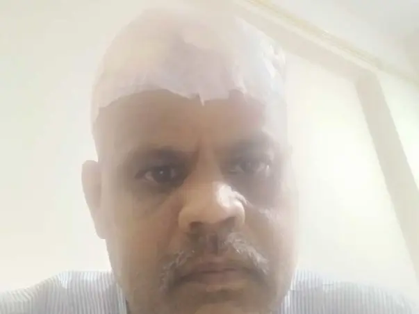 Help for Brain Haemorrhage Operation