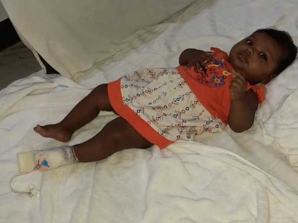 4 Months Old Ananya Needs Your Help To Recover From Ectopic Ureter With Right Duplex Kidney