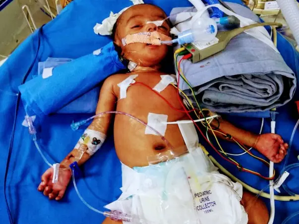 Save This 2 Month Baby