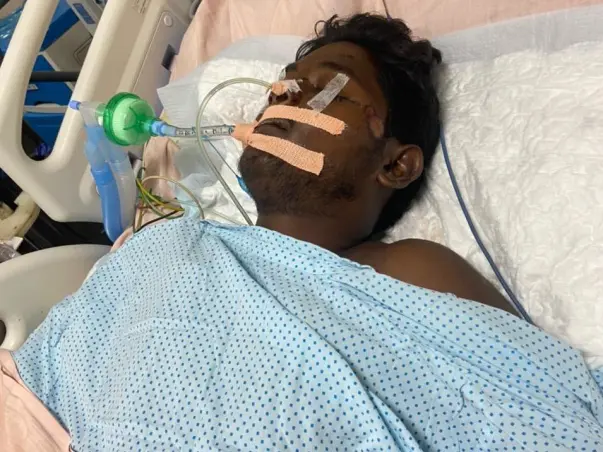 Support Deva Kumar Recover From Accident Head Injury