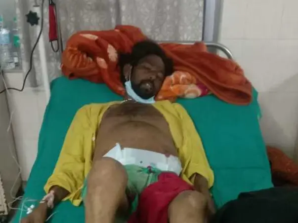 Help Bachubhai Fight Liver Cirrhosis