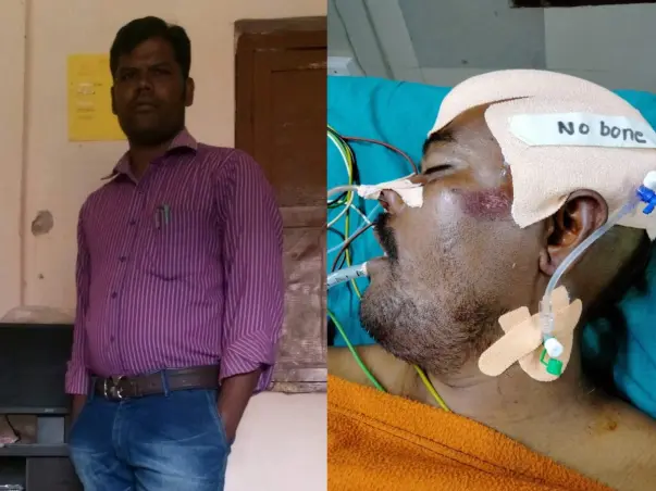 33 Years Old Veerappadora Bangarraju Needs Your Help To Recover Accident