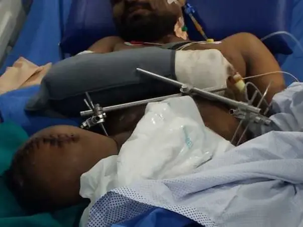 Please Help Sudhakar Recover From Accidental Injuries