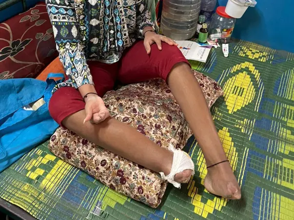 Help differently abled Renuka(with no parents)to Walk & use her Hands
