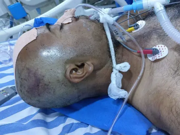 SAVE TAHER HUSSAIN'S LIFE SUFFERING FROM SEVERE BRAIN INJURY
