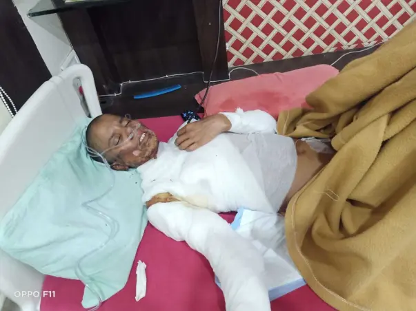 Support Heena Jai To Recover From Skin Burn