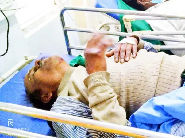52 years old Bishwanath Das needs your help fight Road Accident lead to multiple blood clots in brain