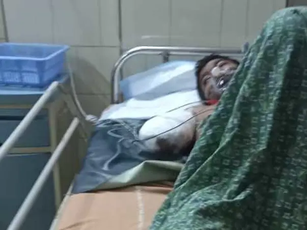 Support Kameswara Kalyana Kumar Recover from Accidental Injuries