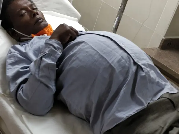 Help My Father Undergo A Liver Transplant