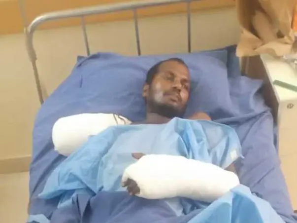 Support Shiva Recover From Multiple Fracture of electrical accident
