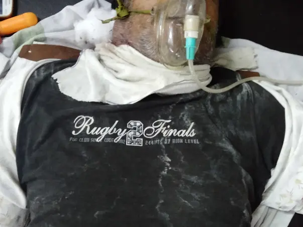 Help Me Recover From Head Injury (Accident)