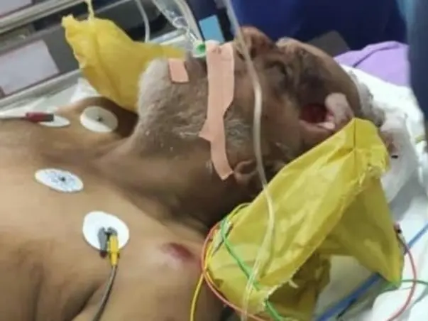 Help my Dad from critical condition