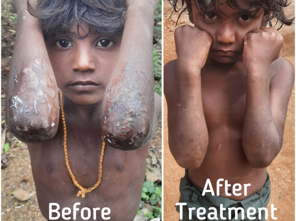 Fundraising Campaign for Construction Of Skill Development Center