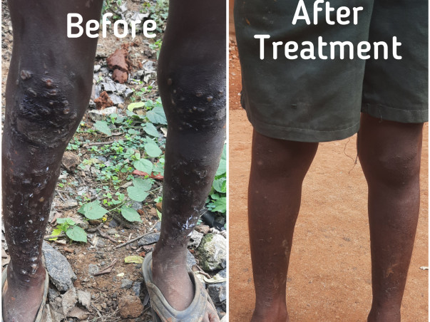 Fundraising Campaign for Construction Of Skill Development Center