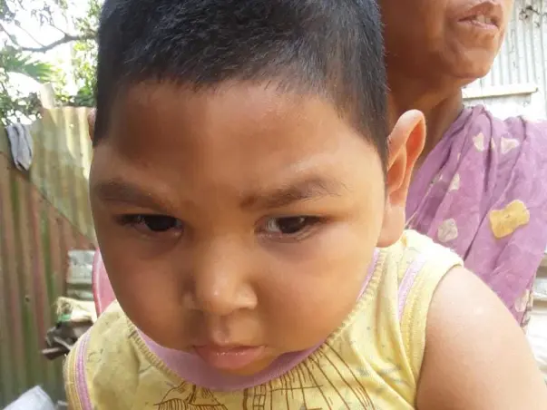 Help Sourav Roy Barman fight hypoxic-ischemic encephalopathy (HIE)