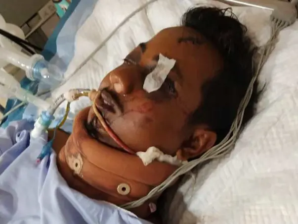 My nephew is in ventilation after a brutal road accident. Please help.