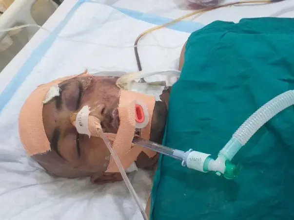 Support Anand Gite Recover From Accidental Brain Injury