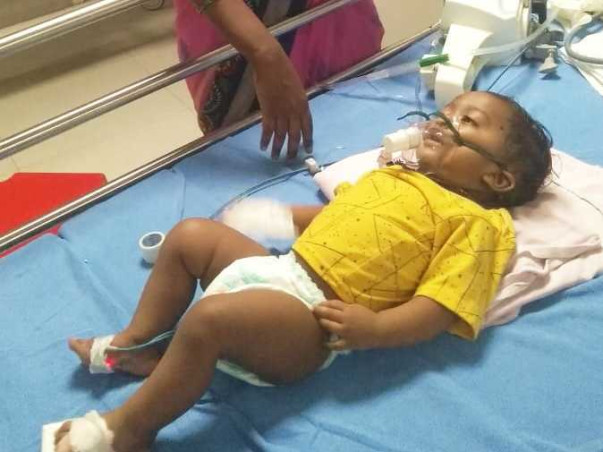 8 months old Revanth Kumar needs your help fight Head injury