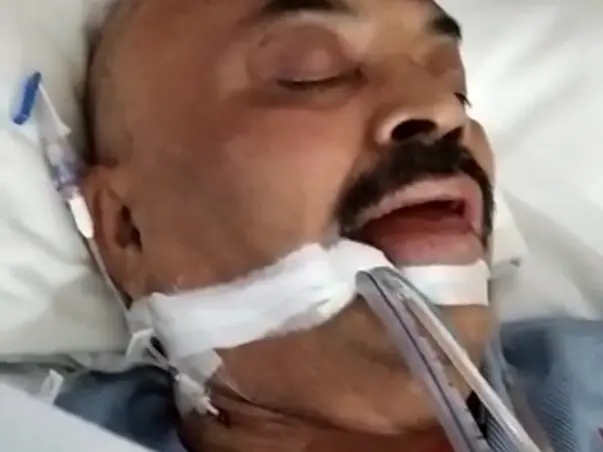 Help My Father Recover From Brain Haemorrhage