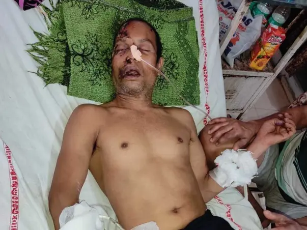 Help my uncle to survive from serious Bus Accident 🙏