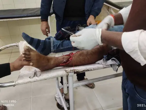 Help Vinay To Get His Leg Operated