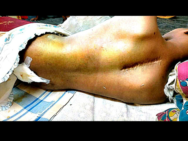 🙏HELP TO VENKATARAMANA OUT OF SPINAL PROBLEM 🙏