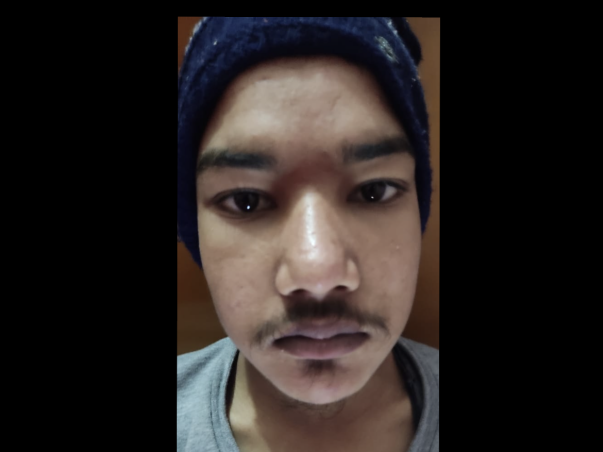 Support Sahaj Kumar Recover From Kidney Failure