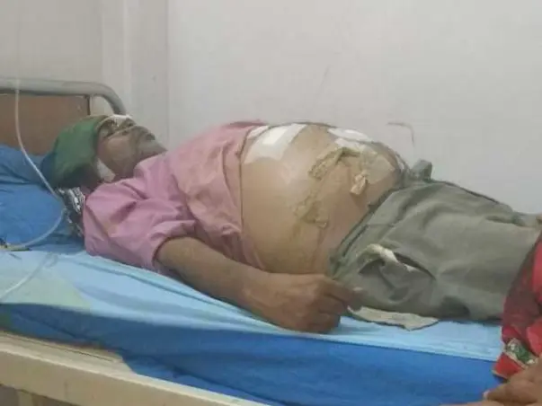 Please help Amar Recover From Severe Stomach Infection