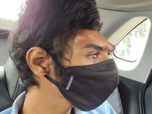 Help My Brother Undergo Brain Surgery.