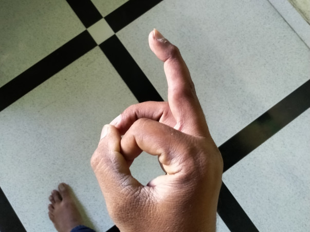 Support Mustakeen Recover From Finger Fracture