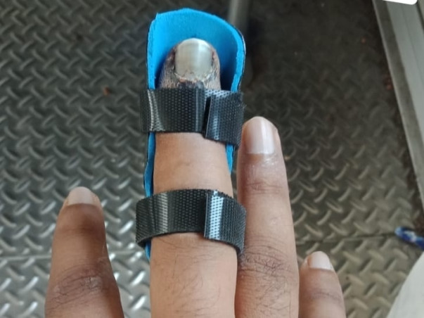 Support Mustakeen Recover From Finger Fracture
