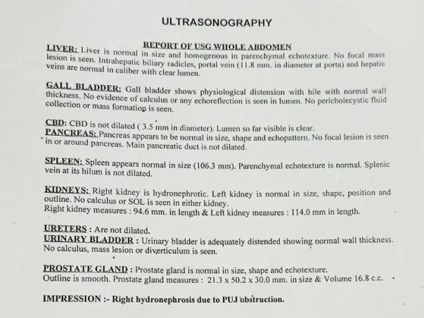 Need help for kidney operation to remove the obstruction in kidney