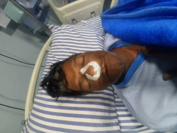 Gopal Gupta Is Suffering From Mucormycosis(Black Fungus) So Help.