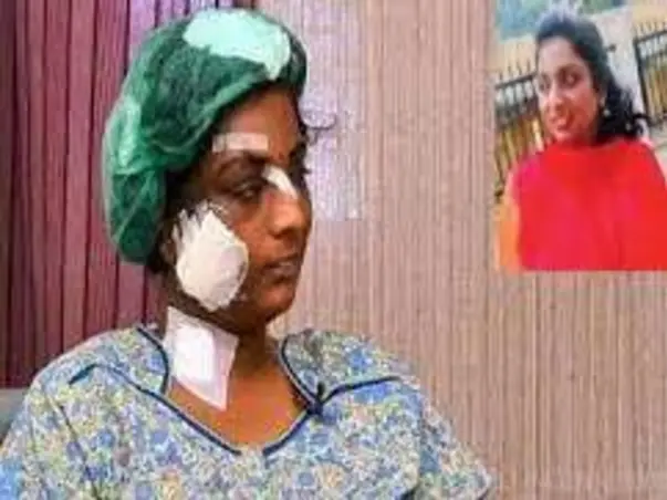 Support Lavanya To Recover From Her Violent Injuries