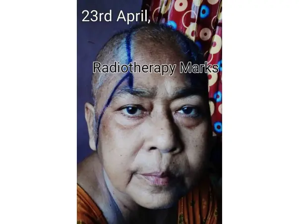 Please Help my mother, "Mrs. Sumita Nandy" to fight against Brain Cancer(Stage 4).