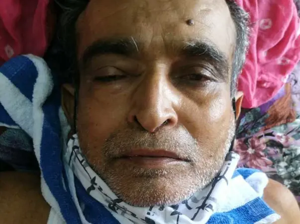 62 Years Old Gandubhai Needs Your Help Recover From Mucormycosis