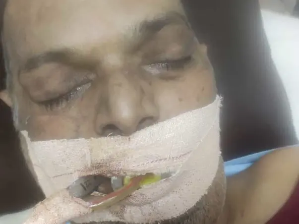 Help My Father Recover From  Lung Infection Due To Covid 19