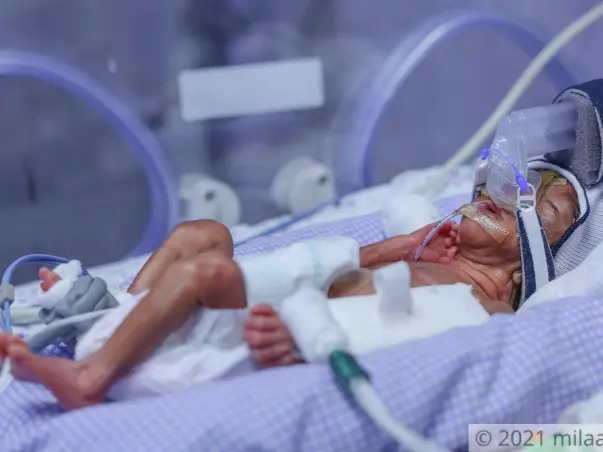 They Finally Became Parents But Their Baby's Life Is At Risk!