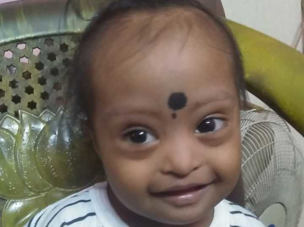 Support Baby Jagadeeshsan To Recover From Complete Atrioventricular Canal