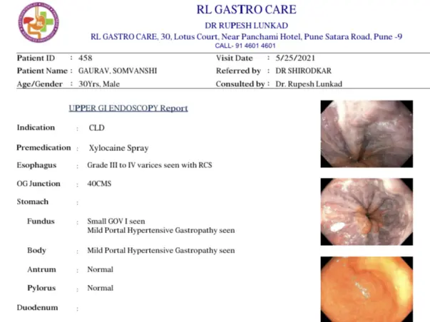 Support Gaurav Somwanshi[Bhavsar] to liver transplantation surgery