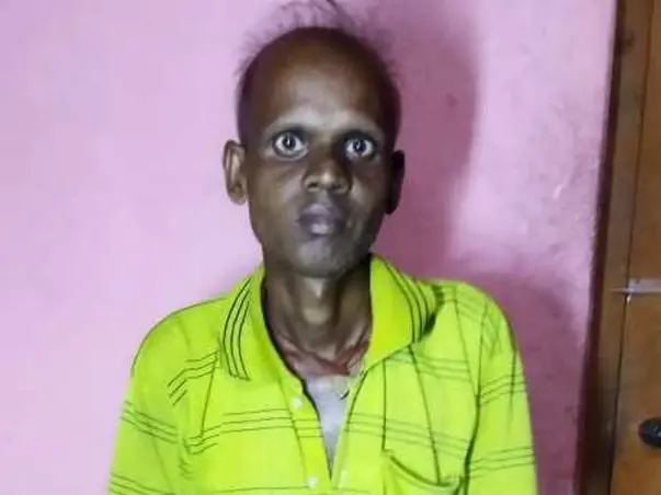 Support "Manoj Kumar Nayak" to Recover From "Stomach Cancer"