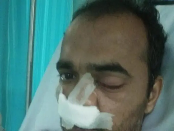 Help Kondal Reddy Recover From Mucormycosis(Black Fungus)