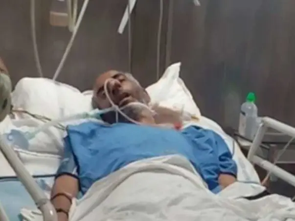 Please Help My Uncle Recover From Brain Tumours