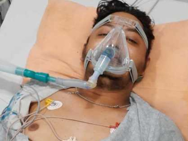 Abhishek Mohapatra To Recover From Covid19 and Ecmo